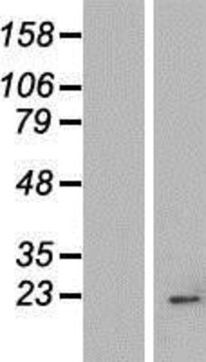 Western Blot: IMP3 Overexpression Lysate (Adult Normal) [NBP2-06811] Left-Empty vector transfected control cell lysate (HEK293 cell lysate); Right -Over-expression Lysate for IMP3.