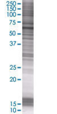 RPS6KL1 transfected lysate.