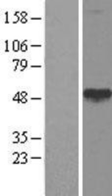 Western Blot: CALR3 Overexpression Lysate (Adult Normal) [NBL1-08656] Left-Empty vector transfected control cell lysate (HEK293 cell lysate); Right -Over-expression Lysate for CALR3.