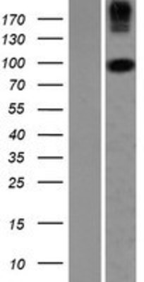 Western Blot: COPG2 Overexpression Lysate (Adult Normal) [NBP2-07488] Left-Empty vector transfected control cell lysate (HEK293 cell lysate); Right -Over-expression Lysate for COPG2.