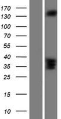 Western Blot: RASGRF2 Overexpression Lysate (Adult Normal) [NBP2-07560] Left-Empty vector transfected control cell lysate (HEK293 cell lysate); Right -Over-expression Lysate for RASGRF2.