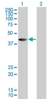 Lane 1: RBED1 transfected lysate (44.3 KDa). Lane 2: Non-transfected lysate.