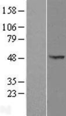 Western Blot: OXSM Overexpression Lysate (Adult Normal) [NBL1-14024] Left-Empty vector transfected control cell lysate (HEK293 cell lysate); Right -Over-expression Lysate for OXSM.
