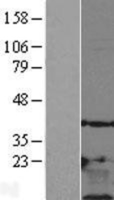 Western Blot: Thymosin beta 10 Overexpression Lysate (Adult Normal) [NBL1-17127] Left-Empty vector transfected control cell lysate (HEK293 cell lysate); Right -Over-expression Lysate for Thymosin beta 10.