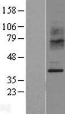 Western Blot: CCR2 Overexpression Lysate (Adult Normal) [NBL1-08889] Left-Empty vector transfected control cell lysate (HEK293 cell lysate); Right -Over-expression Lysate for CCR2.