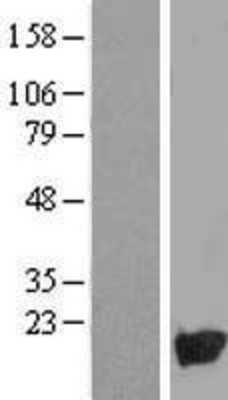 Western Blot: NUDT10 Overexpression Lysate (Adult Normal) [NBL1-13853] Left-Empty vector transfected control cell lysate (HEK293 cell lysate); Right -Over-expression Lysate for NUDT10.