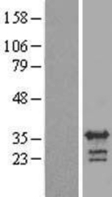 Western Blot: RALYL Overexpression Lysate (Adult Normal) [NBL1-15135] Left-Empty vector transfected control cell lysate (HEK293 cell lysate); Right -Over-expression Lysate for RALYL.