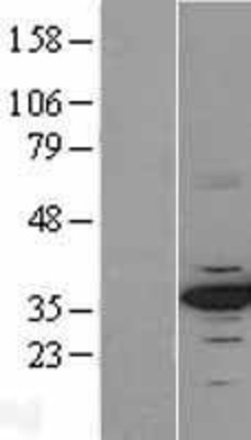 Western Blot: Cdk4 Overexpression Lysate (Adult Normal) [NBL1-09039] Left-Empty vector transfected control cell lysate (HEK293 cell lysate); Right -Over-expression Lysate for Cdk4.