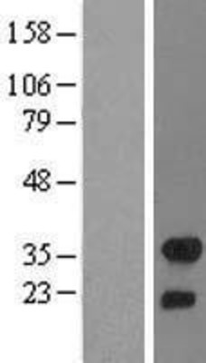 Western Blot: FHL2 Overexpression Lysate (Adult Normal) [NBL1-10715] Left-Empty vector transfected control cell lysate (HEK293 cell lysate); Right -Over-expression Lysate for FHL2.