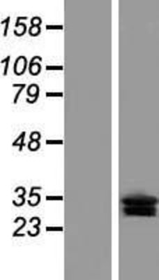 Western Blot: CLRN3 Overexpression Lysate (Adult Normal) [NBL1-09284] Left-Empty vector transfected control cell lysate (HEK293 cell lysate); Right -Over-expression Lysate for CLRN3.