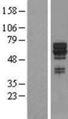 Western Blot: SYT17 Overexpression Lysate (Adult Normal) [NBL1-16650] Left-Empty vector transfected control cell lysate (HEK293 cell lysate); Right -Over-expression Lysate for SYT17.