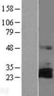 Western Blot: RNF144A Overexpression Lysate (Adult Normal) [NBL1-15427] Left-Empty vector transfected control cell lysate (HEK293 cell lysate); Right -Over-expression Lysate for RNF144A.