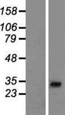 Western Blot: AP1AR Overexpression Lysate (Adult Normal) [NBP2-06788] Left-Empty vector transfected control cell lysate (HEK293 cell lysate); Right -Over-expression Lysate for AP1AR.