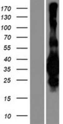 Western Blot: MED29 Overexpression Lysate (Adult Normal) [NBP2-06959] Left-Empty vector transfected control cell lysate (HEK293 cell lysate); Right -Over-expression Lysate for MED29.