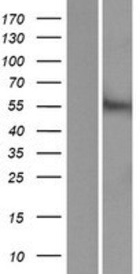 Western Blot: ACCN5 Overexpression Lysate (Adult Normal) [NBP2-06981] Left-Empty vector transfected control cell lysate (HEK293 cell lysate); Right -Over-expression Lysate for ACCN5.