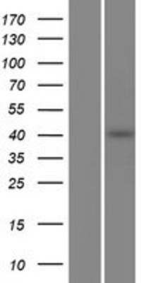 Western Blot: PCMTD2 Overexpression Lysate (Adult Normal) [NBP2-06840] Left-Empty vector transfected control cell lysate (HEK293 cell lysate); Right -Over-expression Lysate for PCMTD2.