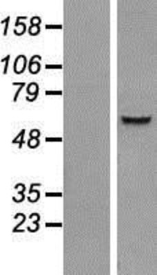 Western Blot: IQCC Overexpression Lysate (Adult Normal) [NBP2-06868] Left-Empty vector transfected control cell lysate (HEK293 cell lysate); Right -Over-expression Lysate for IQCC.