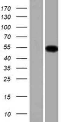 Western Blot: TMCO6 Overexpression Lysate (Adult Normal) [NBP2-06790] Left-Empty vector transfected control cell lysate (HEK293 cell lysate); Right -Over-expression Lysate for TMCO6.