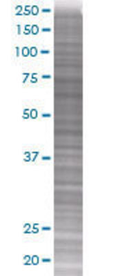 ANAPC5 transfected lysate.