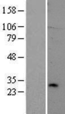 Western Blot: TREM2 Overexpression Lysate (Adult Normal) [NBP2-06751] Left-Empty vector transfected control cell lysate (HEK293 cell lysate); Right -Over-expression Lysate for TREM2.