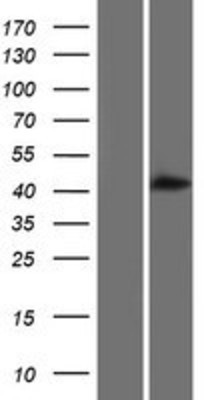 Western Blot: ALLC Overexpression Lysate (Adult Normal) [NBP2-06793] Left-Empty vector transfected control cell lysate (HEK293 cell lysate); Right -Over-expression Lysate for ALLC.