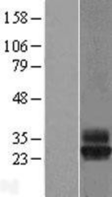Western Blot: Tetraspanin-4 Overexpression Lysate (Adult Normal) [NBL1-17376] Left-Empty vector transfected control cell lysate (HEK293 cell lysate); Right -Over-expression Lysate for Tetraspanin-4.