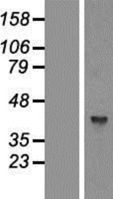 Western Blot: GTPBP5 Overexpression Lysate (Adult Normal) [NBP2-07123] Left-Empty vector transfected control cell lysate (HEK293 cell lysate); Right -Over-expression Lysate for GTPBP5.