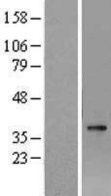 Western Blot: AWAT1 Overexpression Lysate (Adult Normal) [NBL1-09846] Left-Empty vector transfected control cell lysate (HEK293 cell lysate); Right -Over-expression Lysate for AWAT1.