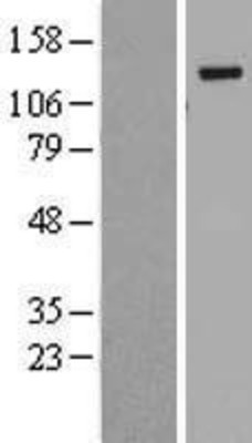 Western Blot: BubR1 Overexpression Lysate (Adult Normal) [NBL1-08057] Left-Empty vector transfected control cell lysate (HEK293 cell lysate); Right -Over-expression Lysate for BubR1.