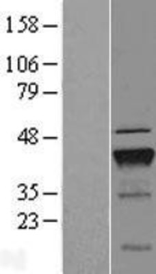 Western Blot: PDCD2L Overexpression Lysate (Adult Normal) [NBL1-14207] Left-Empty vector transfected control cell lysate (HEK293 cell lysate); Right -Over-expression Lysate for PDCD2L.
