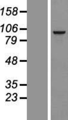 Western Blot: RSPH10B Overexpression Lysate (Adult Normal) [NBL1-15599] Left-Empty vector transfected control cell lysate (HEK293 cell lysate); Right -Over-expression Lysate for RSPH10B.