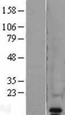 Western Blot: VAMP8 Overexpression Lysate (Adult Normal) [NBL1-17691] Left-Empty vector transfected control cell lysate (HEK293 cell lysate); Right -Over-expression Lysate for VAMP8.