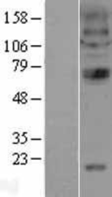 Western Blot: Nicotinic Acetylcholine Receptor alpha 4 Overexpression Lysate (Adult Normal) [NBL1-09181] Left-Empty vector transfected control cell lysate (HEK293 cell lysate); Right -Over-expression Lysate for Nicotinic Acetylcholine Receptor alpha 4.