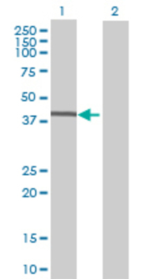 Lane 1: MTMR1 transfected lysate (40.04 KDa) Lane 2: Non-transfected lysate.