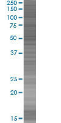 MYOC transfected lysate.