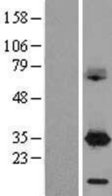 Western Blot: DAPP1 Overexpression Lysate (Adult Normal) [NBL1-09718] Left-Empty vector transfected control cell lysate (HEK293 cell lysate); Right -Over-expression Lysate for DAPP1.