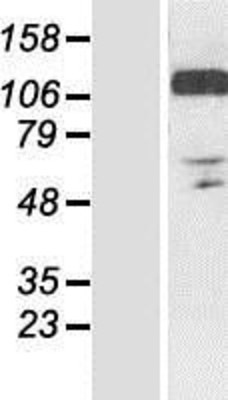 Western Blot: RANBP10 Overexpression Lysate (Adult Normal) [NBP2-06601] Left-Empty vector transfected control cell lysate (HEK293 cell lysate); Right -Over-expression Lysate for RANBP10.