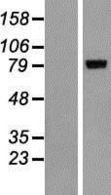 Western Blot: ALOXE3 Overexpression Lysate (Adult Normal) [NBP2-06525] Left-Empty vector transfected control cell lysate (HEK293 cell lysate); Right -Over-expression Lysate for ALOXE3.