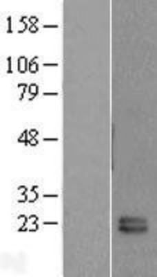 Western Blot: FKBP11 Overexpression Lysate (Adult Normal) [NBL1-10730] Left-Empty vector transfected control cell lysate (HEK293 cell lysate); Right -Over-expression Lysate for FKBP11.