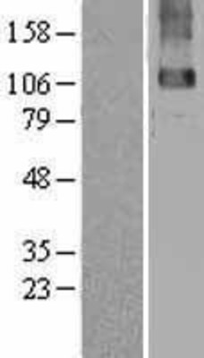 Western Blot: GABA B Receptor 2 Overexpression Lysate (Adult Normal) [NBL1-10910] Left-Empty vector transfected control cell lysate (HEK293 cell lysate); Right -Over-expression Lysate for GABA B Receptor 2.