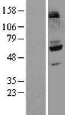 Western Blot: Flavin containing monooxygenase 4 Overexpression Lysate (Adult Normal) [NBL1-10777] Left-Empty vector transfected control cell lysate (HEK293 cell lysate); Right -Over-expression Lysate for Flavin containing monooxygenase 4.