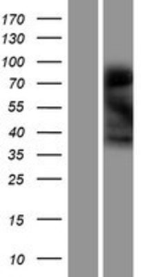 Western Blot: LMOD3 Overexpression Lysate (Adult Normal) [NBP2-04715] Left-Empty vector transfected control cell lysate (HEK293 cell lysate); Right -Over-expression Lysate for LMOD3.