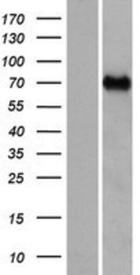 Western Blot: CCDC37 Overexpression Lysate (Adult Normal) [NBP2-04822] Left-Empty vector transfected control cell lysate (HEK293 cell lysate); Right -Over-expression Lysate for CCDC37.