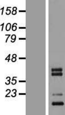 Western Blot: CTRP3 Overexpression Lysate (Adult Normal) [NBP2-04922] Left-Empty vector transfected control cell lysate (HEK293 cell lysate); Right -Over-expression Lysate for CTRP3.