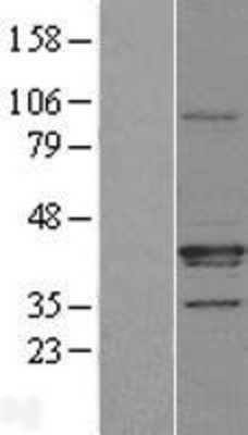 Western Blot: FAM108A1 Overexpression Lysate (Adult Normal) [NBL1-10439] Left-Empty vector transfected control cell lysate (HEK293 cell lysate); Right -Over-expression Lysate for FAM108A1.
