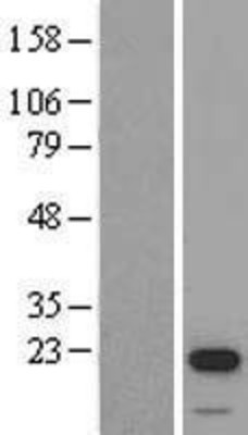 Western Blot: STK32A Overexpression Lysate (Adult Normal) [NBL1-16549] Left-Empty vector transfected control cell lysate (HEK293 cell lysate); Right -Over-expression Lysate for STK32A.