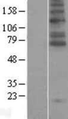 Western Blot: SLC6A5 Overexpression Lysate (Adult Normal) [NBL1-16181] Left-Empty vector transfected control cell lysate (HEK293 cell lysate); Right -Over-expression Lysate for SLC6A5.