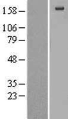 Western Blot: Alpha 2 Macroglobulin Overexpression Lysate (Adult Normal) [NBL1-07157] Left-Empty vector transfected control cell lysate (HEK293 cell lysate); Right -Over-expression Lysate for Alpha 2 Macroglobulin.