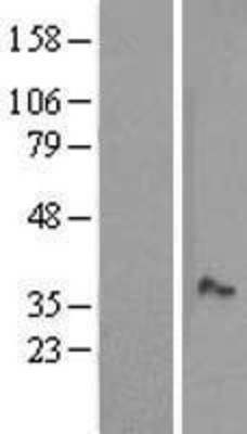Western Blot: MOSC1 Overexpression Lysate (Adult Normal) [NBL1-13189] Left-Empty vector transfected control cell lysate (HEK293 cell lysate); Right -Over-expression Lysate for MOSC1.