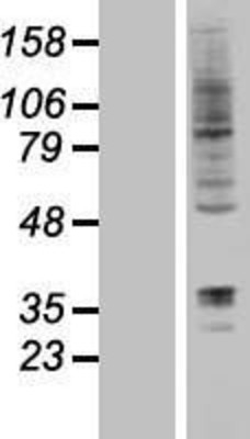 Western Blot: DORFIN Overexpression Lysate (Adult Normal) [NBP2-04770] Left-Empty vector transfected control cell lysate (HEK293 cell lysate); Right -Over-expression Lysate for DORFIN.